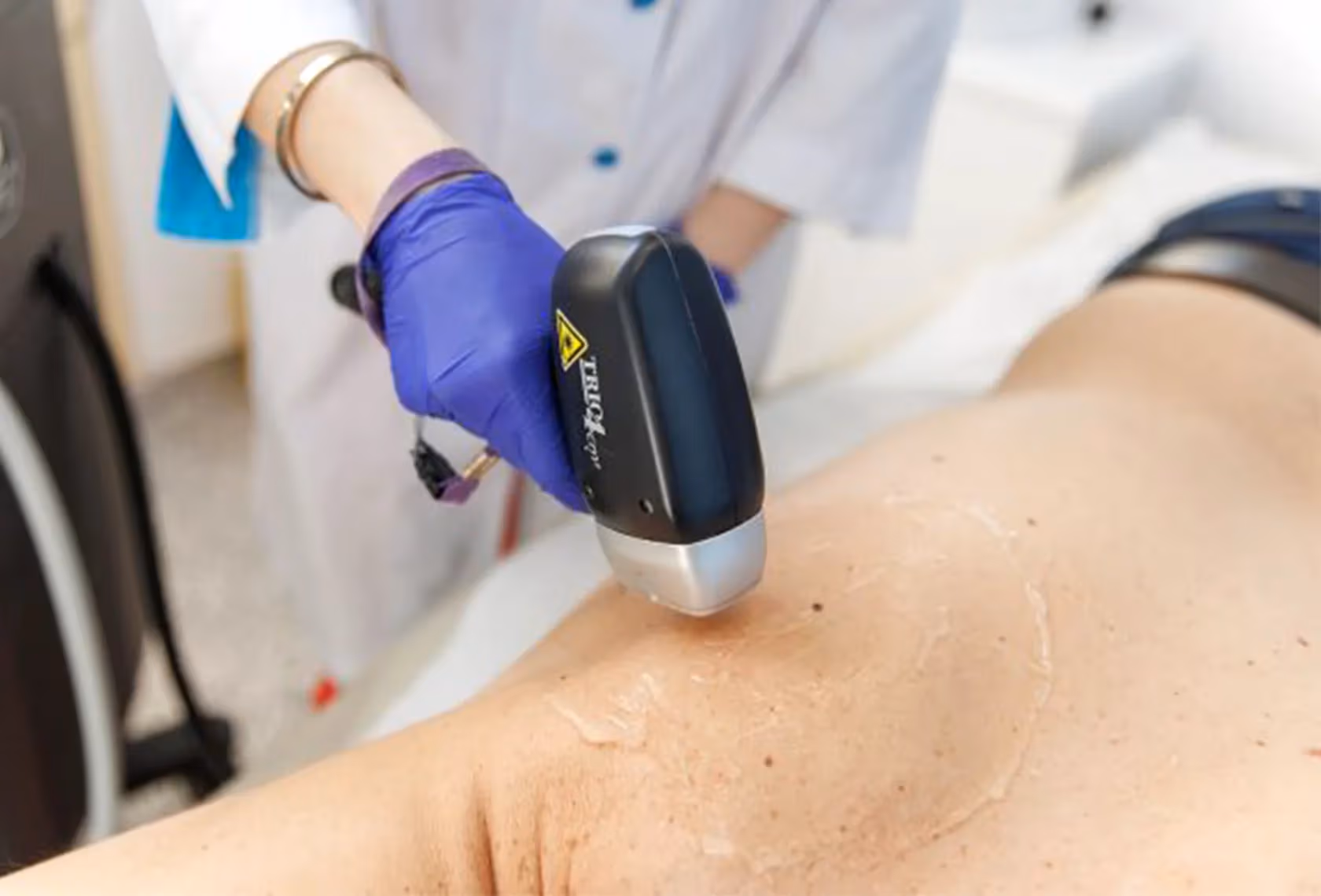 Full Body Laser Hair Removal for Men